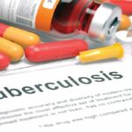 Nigeria faces urgent tuberculosis epidemic amid funding shortfall