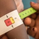 United Nations raises alarm over rising malnutrition levels in northeast Nigeria